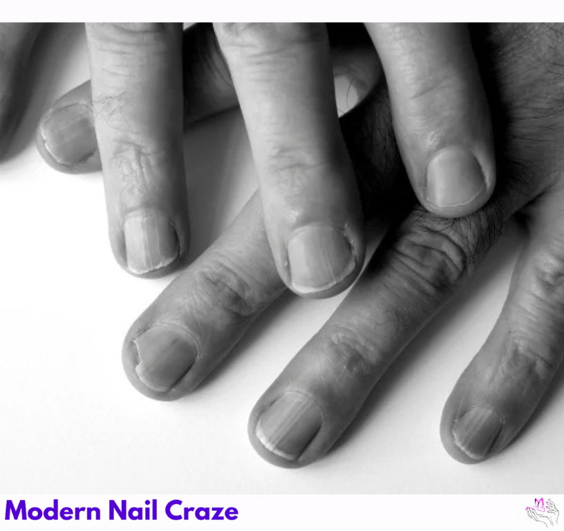 What Causes Nails to Curve Downward