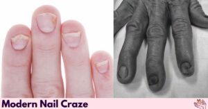 Curved Nails: Causes, Types